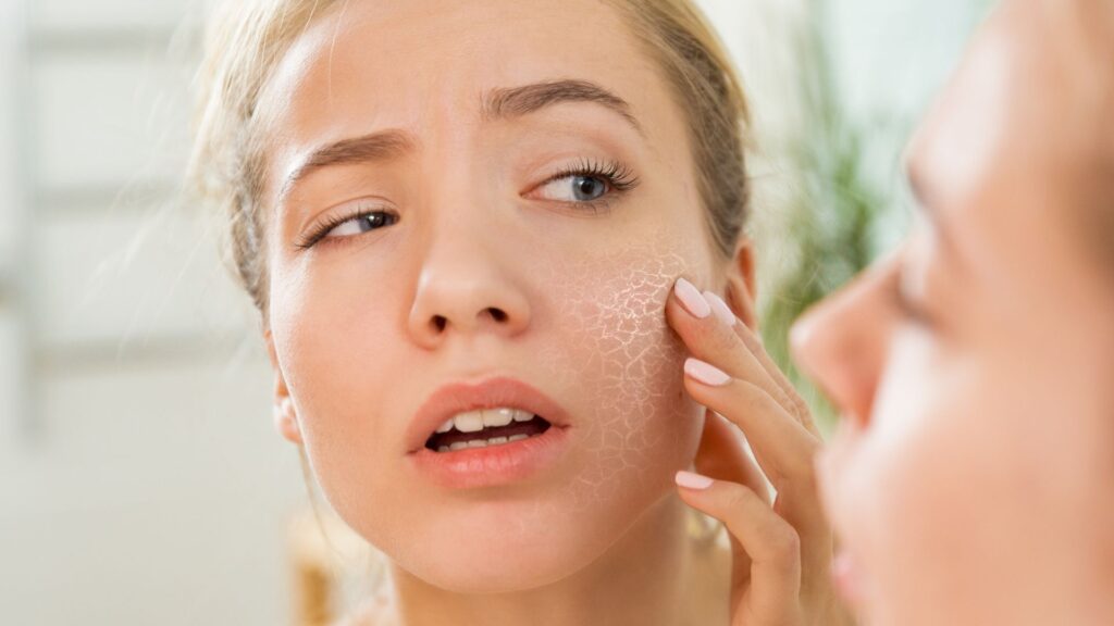 dry skin natural remedies