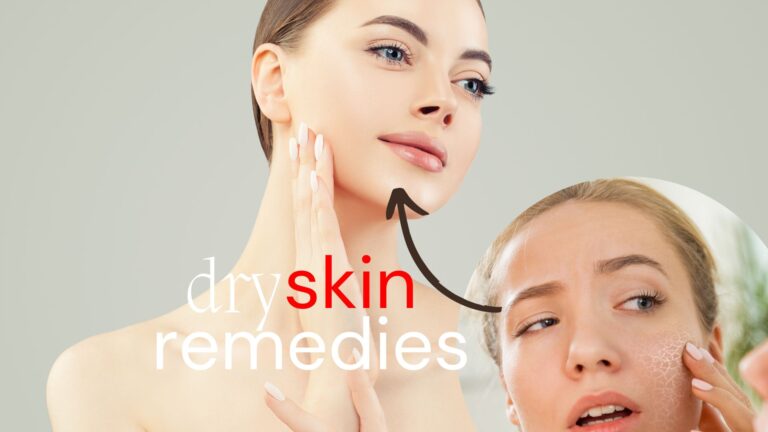 dry-skin-remedies